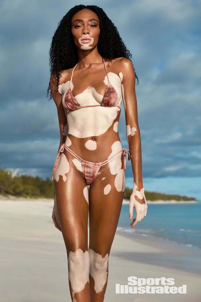 Winnie Harlow